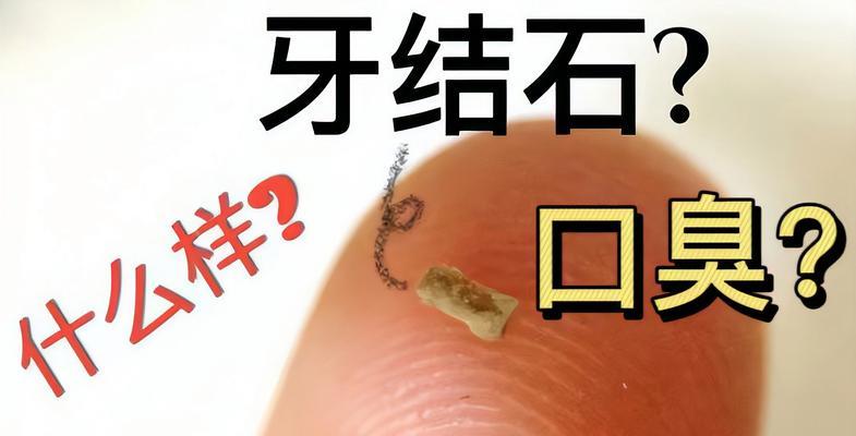 解决网络慢的方法（1分钟教你如何解决网络慢的问题）